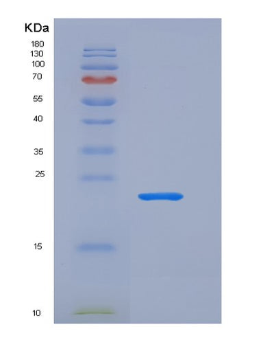 SDS-PAGE analysis of Human LCN2 (Neutrophil Gelatinase-Associated Lipocalin) - Recombinant Protein, CAT# BLT-05811P, showing >90% purity under 15% SDS-PAGE (Reduced)Human LCN2 (Neutrophil Gelatinase-Associated Lipocalin) - Recombinant Protein