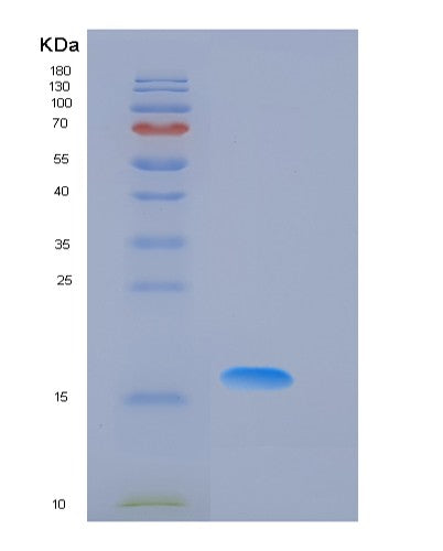 SDS-PAGE analysis of Mouse Fasn (Fatty Acid Synthase) - Recombinant Protein, CATMouse Fasn (Fatty Acid Synthase) - Recombinant Protein