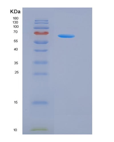 SDS-PAGE analysis of Human CSF3R (Granulocyte Colony-Stimulating Factor Receptor) - Recombinant Protein, CAT# BLT-05813P, showing >85% purity under 15% SDS-PAGE (Reduced)Human CSF3R (Granulocyte Colony-Stimulating Factor Receptor) - Recombinant Protein