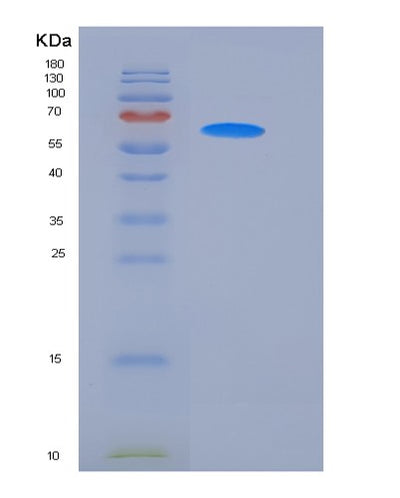SDS-PAGE analysis of Mouse Cd14 (Monocyte Differentiation Antigen Cd14) - Recombinant Protein, CAT# BLT-05814P, showing >90% purity under 15% SDS-PAGE (Reduced)Mouse Cd14 (Monocyte Differentiation Antigen Cd14) - Recombinant Protein