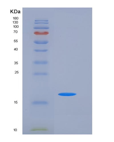 SDS-PAGE analysis of Human NBL1 (Neuroblastoma Suppressor Of Tumorigenicity 1) - Recombinant Protein, CAT# BLT-05815P, showing >85% purity under 15% SDS-PAGE (Reduced)Human NBL1 (Neuroblastoma Suppressor Of Tumorigenicity 1) - Recombinant Protein