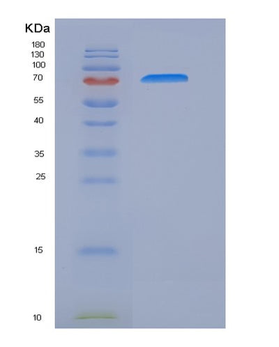 SDS-PAGE analysis of Human IL17RC (Interleukin-17 Receptor C) - Recombinant Protein, CAT# BLT-05820P, showing >95% purity under 15% SDS-PAGE (Reduced)Human IL17RC (Interleukin-17 Receptor C) - Recombinant Protein