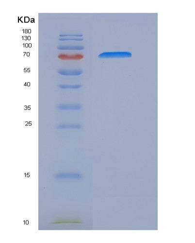 SDS-PAGE analysis of Human IL17RC (Interleukin-17 Receptor C) - Recombinant Protein, CATHuman IL17RC (Interleukin-17 Receptor C) - Recombinant Protein