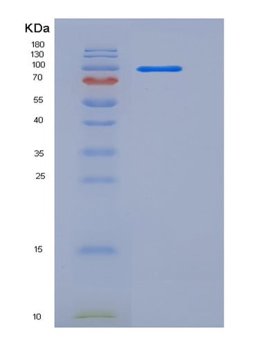 SDS-PAGE analysis of Human C2 (Complement C2) - Recombinant Protein, CAT# BLT-05831P, showing >95% purity under 15% SDS-PAGE (Reduced)Human C2 (Complement C2) - Recombinant Protein