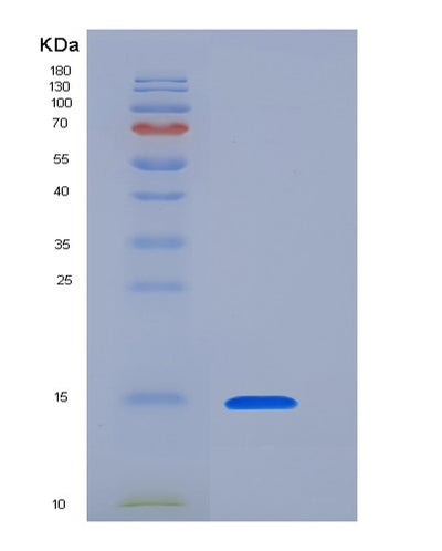 SDS-PAGE analysis of Human CLEC7A (C-Type Lectin Domain Family 7 Member A) - Recombinant Protein, CAT# BLT-05833P, showing >95% purity under 15% SDS-PAGE (Reduced)Human CLEC7A (C-Type Lectin Domain Family 7 Member A) - Recombinant Protein