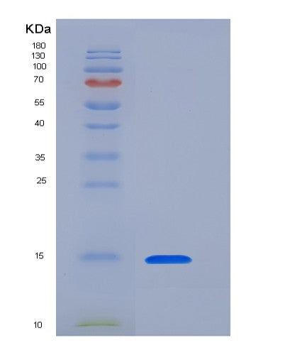 SDS-PAGE analysis of Human CLEC7A (C-Type Lectin Domain Family 7 Member A) - Recombinant Protein, CATHuman CLEC7A (C-Type Lectin Domain Family 7 Member A) - Recombinant Protein