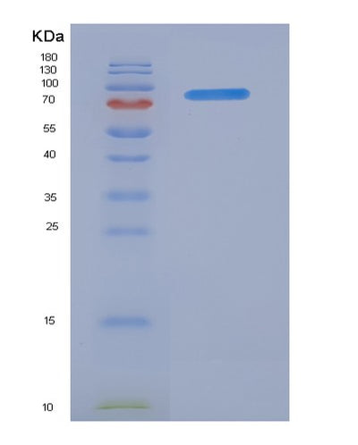 SDS-PAGE analysis of Human FAP (Prolyl Endopeptidase Fap) - Recombinant Protein, CAT# BLT-05834P, showing >85% purity under 15% SDS-PAGE (Reduced)Human FAP (Prolyl Endopeptidase Fap) - Recombinant Protein