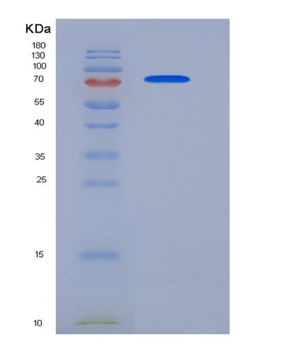 SDS-PAGE analysis of Human ECE1 (Endothelin-Converting Enzyme 1) - Recombinant Protein, CAT# BLT-05837P, showing >90% purity under 15% SDS-PAGE (Reduced)Human ECE1 (Endothelin-Converting Enzyme 1) - Recombinant Protein