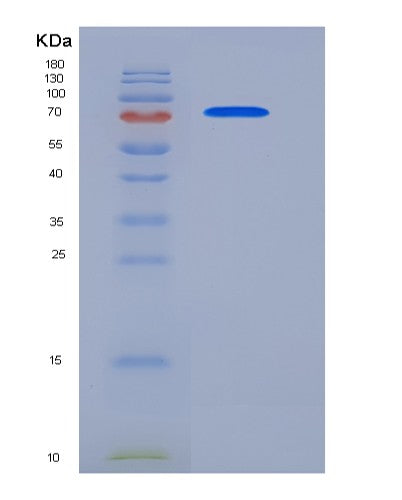SDS-PAGE analysis of Human ECE1 (Endothelin-Converting Enzyme 1) - Recombinant Protein, CATHuman ECE1 (Endothelin-Converting Enzyme 1) - Recombinant Protein