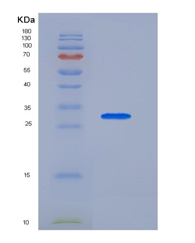 SDS-PAGE analysis of Human FCRL1 (Fc Receptor-Like Protein 1) - Recombinant Protein, CATHuman FCRL1 (Fc Receptor-Like Protein 1) - Recombinant Protein