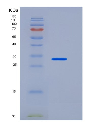 SDS-PAGE analysis of Human CEACAM8 (Cell Adhesion Molecule Ceacam8) - Recombinant Protein, CATHuman CEACAM8 (Cell Adhesion Molecule Ceacam8) - Recombinant Protein