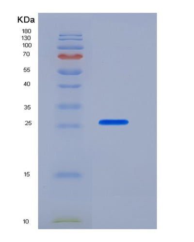 SDS-PAGE analysis of Mouse Cd274 (Programmed Cell Death 1 Ligand 1) - Recombinant Protein, CAT# BLT-05843P, showing >85% purity under 15% SDS-PAGE (Reduced)Mouse Cd274 (Programmed Cell Death 1 Ligand 1) - Recombinant Protein