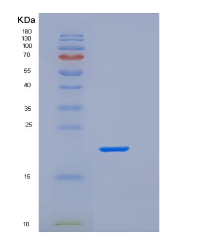 SDS-PAGE analysis of Human FCGR2A (Low Affinity Immunoglobulin Gamma Fc Region Receptor Ii-A) - Recombinant Protein, CAT# BLT-05845P, showing >95% purity under 15% SDS-PAGE (Reduced)Human FCGR2A (Low Affinity Immunoglobulin Gamma Fc Region Receptor Ii-A) - Recombinant Protein