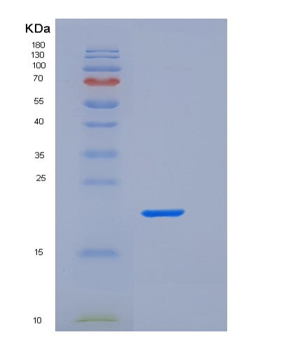 SDS-PAGE analysis of Human FCGR2A (Low Affinity Immunoglobulin Gamma Fc Region Receptor Ii-A) - Recombinant Protein, CATHuman FCGR2A (Low Affinity Immunoglobulin Gamma Fc Region Receptor Ii-A) - Recombinant Protein