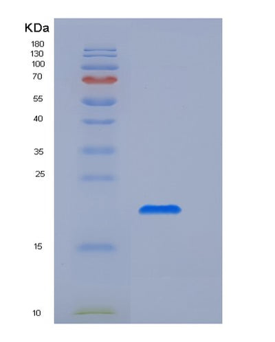SDS-PAGE analysis of Human FCGR2A (Low Affinity Immunoglobulin Gamma Fc Region Receptor Ii-A) - Recombinant Protein, CAT# BLT-05846P, showing >95% purity under 15% SDS-PAGE (Reduced)Human FCGR2A (Low Affinity Immunoglobulin Gamma Fc Region Receptor Ii-A) - Recombinant Protein
