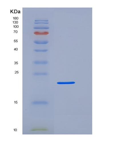 SDS-PAGE analysis of Human FCGR3A (Low Affinity Immunoglobulin Gamma Fc Region Receptor Iii-A) - Recombinant Protein, CAT# BLT-05852P, showing >95% purity under 15% SDS-PAGE (Reduced)Human FCGR3A (Low Affinity Immunoglobulin Gamma Fc Region Receptor Iii-A) - Recombinant Protein