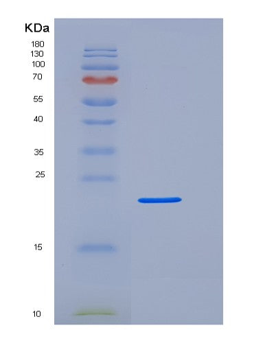 SDS-PAGE analysis of Human FCGR3A (Low Affinity Immunoglobulin Gamma Fc Region Receptor Iii-A) - Recombinant Protein, CATHuman FCGR3A (Low Affinity Immunoglobulin Gamma Fc Region Receptor Iii-A) - Recombinant Protein