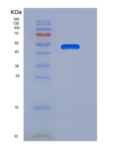 SDS-PAGE analysis of Human LXN (Latexin) - Recombinant Protein, CAT# BLT-05854P, showing >85% purity under 15% SDS-PAGE (Reduced)Human LXN (Latexin) - Recombinant Protein