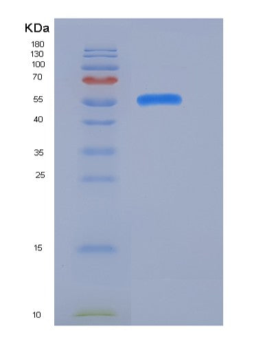 SDS-PAGE analysis of Mouse Alcam (Cd166 Antigen) - Recombinant Protein, CATMouse Alcam (Cd166 Antigen) - Recombinant Protein