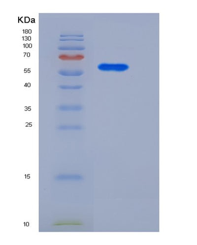 SDS-PAGE analysis of Human MCAM (Cell Surface Glycoprotein Muc18) - Recombinant Protein, CAT# BLT-05860P, showing >85% purity under 15% SDS-PAGE (Reduced)Human MCAM (Cell Surface Glycoprotein Muc18) - Recombinant Protein