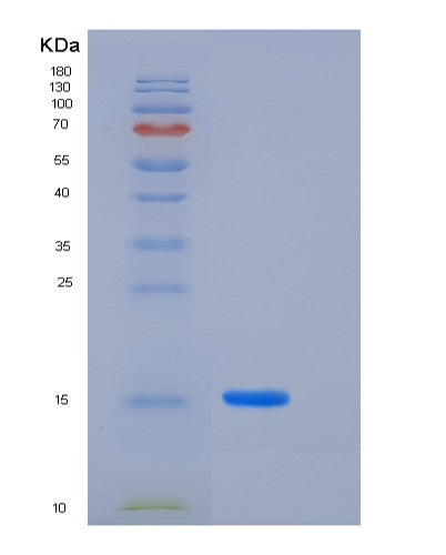 SDS-PAGE analysis of Human LAIR2 (Leukocyte-Associated Immunoglobulin-Like Receptor 2) - Recombinant Protein, CATHuman LAIR2 (Leukocyte-Associated Immunoglobulin-Like Receptor 2) - Recombinant Protein
