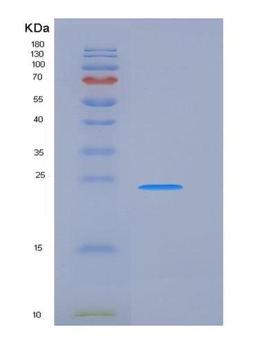 SDS-PAGE analysis of Human FCER1A (High Affinity Immunoglobulin Epsilon Receptor Subunit Alpha) - Recombinant Protein, CAT# BLT-05868P, showing >90% purity under 15% SDS-PAGE (Reduced)Human FCER1A (High Affinity Immunoglobulin Epsilon Receptor Subunit Alpha) - Recombinant Protein