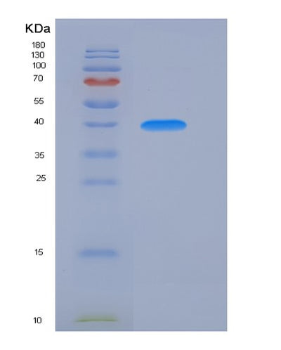 SDS-PAGE analysis of Human CLTRN (Collectrin) - Recombinant Protein, CAT# BLT-05869P, showing >90% purity under 15% SDS-PAGE (Reduced)Human CLTRN (Collectrin) - Recombinant Protein