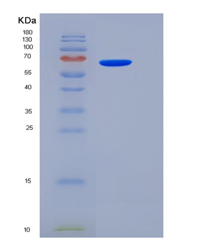 SDS-PAGE analysis of Human PVR (Poliovirus Receptor) - Recombinant Protein, CAT# BLT-05875P, showing >85% purity under 15% SDS-PAGE (Reduced)Human PVR (Poliovirus Receptor) - Recombinant Protein