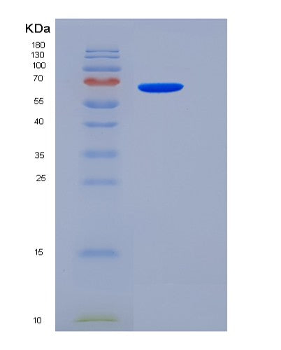 SDS-PAGE analysis of Human PVR (Poliovirus Receptor) - Recombinant Protein, CATHuman PVR (Poliovirus Receptor) - Recombinant Protein