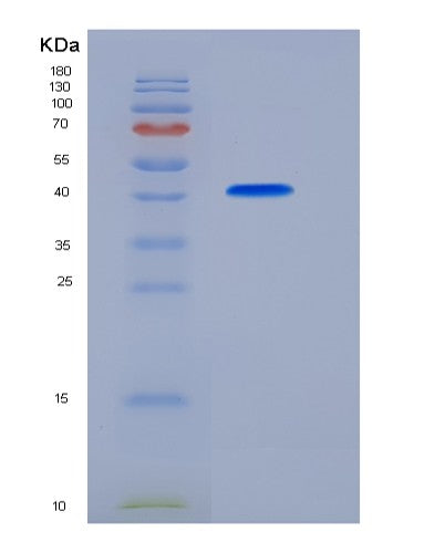 SDS-PAGE analysis of Human FCGRT (Igg Receptor Fcrn Large Subunit P51) - Recombinant Protein, CATHuman FCGRT (Igg Receptor Fcrn Large Subunit P51) - Recombinant Protein