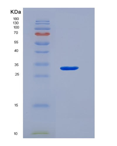 SDS-PAGE analysis of Human FCRL1 (Fc Receptor-Like Protein 1) - Recombinant Protein, CAT# BLT-05881P, showing >90% purity under 15% SDS-PAGE (Reduced)Human FCRL1 (Fc Receptor-Like Protein 1) - Recombinant Protein