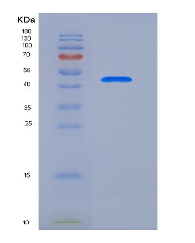 SDS-PAGE analysis of Human ADGRG5 (Adhesion G-Protein Coupled Receptor G5) - Recombinant Protein, CAT# BLT-05883P, showing >95% purity under 15% SDS-PAGE (Reduced)Human ADGRG5 (Adhesion G-Protein Coupled Receptor G5) - Recombinant Protein