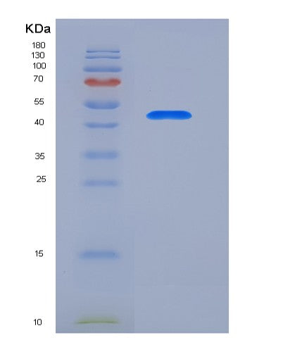 SDS-PAGE analysis of Human ADGRG5 (Adhesion G-Protein Coupled Receptor G5) - Recombinant Protein, CATHuman ADGRG5 (Adhesion G-Protein Coupled Receptor G5) - Recombinant Protein