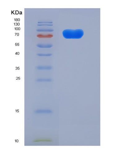 SDS-PAGE analysis of Mouse Enpp2 (Autotaxin) - Recombinant Protein, CAT# BLT-05884P, showing >85% purity under 15% SDS-PAGE (Reduced)Mouse Enpp2 (Autotaxin) - Recombinant Protein