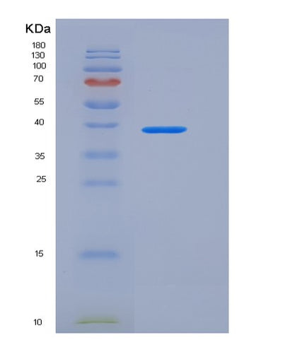SDS-PAGE analysis of Human NECTIN3 (Nectin-3) - Recombinant Protein, CAT# BLT-05886P, showing >90% purity under 15% SDS-PAGE (Reduced)Human NECTIN3 (Nectin-3) - Recombinant Protein