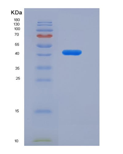 SDS-PAGE analysis of Human FCGRT (Igg Receptor Fcrn Large Subunit P51) - Recombinant Protein, CAT# BLT-08428P showing >85% purity under 15% SDS-PAGE (Reduced)Human FCGRT (Igg Receptor Fcrn Large Subunit P51) - Recombinant Protein