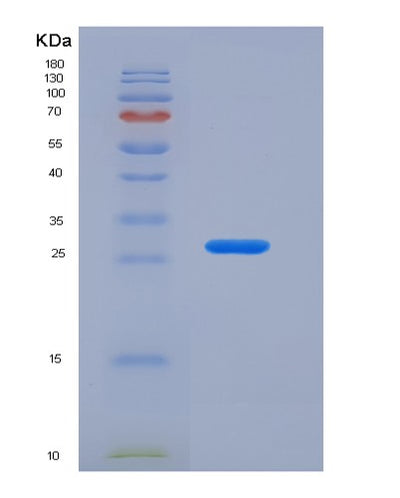 SDS-PAGE analysis of Human CD274 (Programmed Cell Death 1 Ligand 1) - Recombinant Protein, CAT# BLT-05887P, showing >90% purity under 15% SDS-PAGE (Reduced)Human CD274 (Programmed Cell Death 1 Ligand 1) - Recombinant Protein