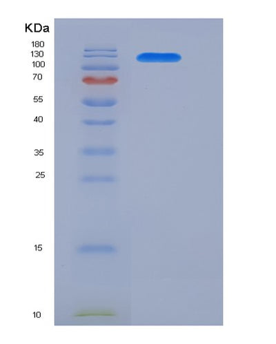 SDS-PAGE analysis of Human JAG1 (Protein Jagged-1) - Recombinant Protein, CAT# BLT-05889P, showing >95% purity under 15% SDS-PAGE (Reduced)Human JAG1 (Protein Jagged-1) - Recombinant Protein