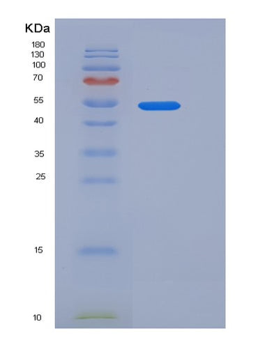 SDS-PAGE analysis of Human CD274 (Programmed Cell Death 1 Ligand 1) - Recombinant Protein, CAT# BLT-05893P, showing >85% purity under 15% SDS-PAGE (Reduced)Human CD274 (Programmed Cell Death 1 Ligand 1) - Recombinant Protein