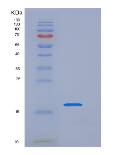 SDS-PAGE analysis of Human LAIR1 (Leukocyte-Associated Immunoglobulin-Like Receptor 1) - Recombinant Protein, CAT# BLT-05894P, showing >95% purity under 15% SDS-PAGE (Reduced)Human LAIR1 (Leukocyte-Associated Immunoglobulin-Like Receptor 1) - Recombinant Protein