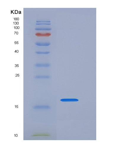 SDS-PAGE analysis of Human LAIR1 (Leukocyte-Associated Immunoglobulin-Like Receptor 1) - Recombinant Protein, CATHuman LAIR1 (Leukocyte-Associated Immunoglobulin-Like Receptor 1) - Recombinant Protein