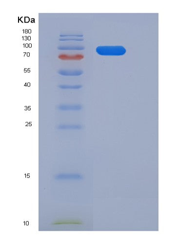 SDS-PAGE analysis of Human ERBB3 (Receptor Tyrosine-Protein Kinase Erbb-3) - Recombinant Protein, CATHuman ERBB3 (Receptor Tyrosine-Protein Kinase Erbb-3) - Recombinant Protein