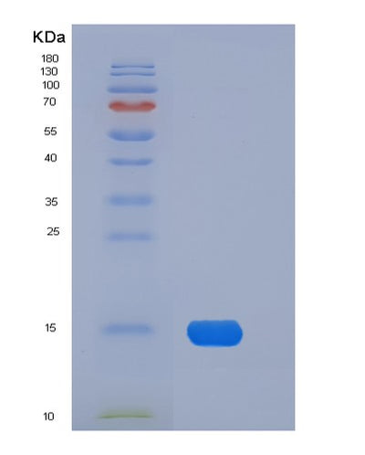 SDS-PAGE analysis of Mouse Fabp4 (Fatty Acid-Binding Protein, Adipocyte) - Recombinant Protein, CAT# BLT-05897P, showing >95% purity under 15% SDS-PAGE (Reduced)Mouse Fabp4 (Fatty Acid-Binding Protein, Adipocyte) - Recombinant Protein