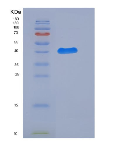 SDS-PAGE analysis of Human LGALS7 (Galectin-7) - Recombinant Protein, CAT# BLT-05899P, showing >85% purity under 15% SDS-PAGE (Reduced)Human LGALS7 (Galectin-7) - Recombinant Protein