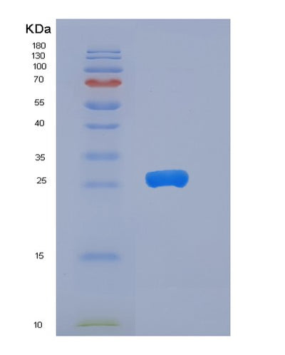 SDS-PAGE analysis of Human YWHAB (14-3-3 Protein Beta/Alpha) - Recombinant Protein, CAT# BLT-05902P, showing >85% purity under 15% SDS-PAGE (Reduced)Human YWHAB (14-3-3 Protein Beta/Alpha) - Recombinant Protein
