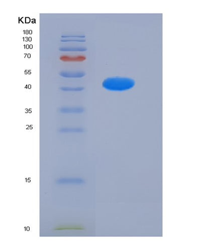 SDS-PAGE analysis of Human LILRB3 (Leukocyte Immunoglobulin-Like Receptor Subfamily B Member 3) - Recombinant Protein, CAT# BLT-05907P, showing >95% purity under 15% SDS-PAGE (Reduced)Human LILRB3 (Leukocyte Immunoglobulin-Like Receptor Subfamily B Member 3) - Recombinant Protein