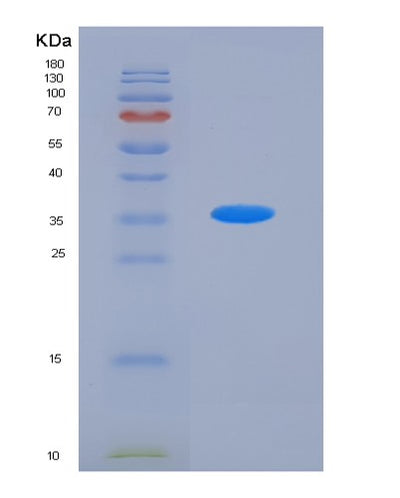 SDS-PAGE analysis of Human ACVRL1 (Activin Receptor Type-1-Like) - Recombinant Protein, CAT# BLT-05908P, showing >90% purity under 15% SDS-PAGE (Reduced)Human ACVRL1 (Activin Receptor Type-1-Like) - Recombinant Protein