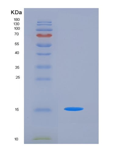 SDS-PAGE analysis of Human CD47 (Leukocyte Surface Antigen Cd47) - Recombinant Protein, CAT# BLT-05909P, showing >85% purity under 15% SDS-PAGE (Reduced)Human CD47 (Leukocyte Surface Antigen Cd47) - Recombinant Protein