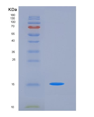SDS-PAGE analysis of Human CD47 (Leukocyte Surface Antigen Cd47) - Recombinant Protein, CATHuman CD47 (Leukocyte Surface Antigen Cd47) - Recombinant Protein