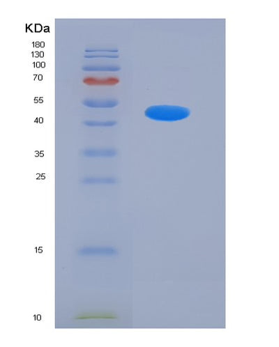 SDS-PAGE analysis of Human BACE1 (Beta-Secretase 1) - Recombinant Protein, CAT# BLT-05913P, showing >95% purity under 15% SDS-PAGE (Reduced)Human BACE1 (Beta-Secretase 1) - Recombinant Protein